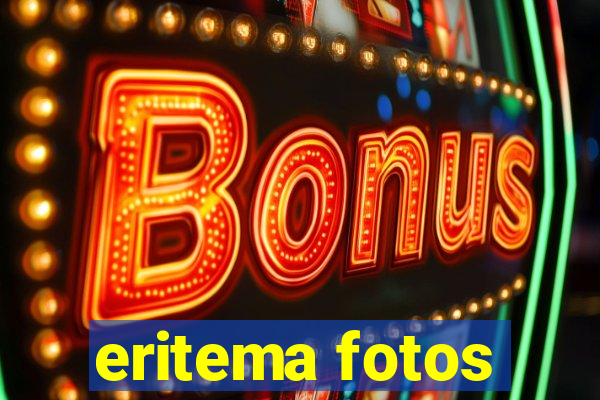 eritema fotos